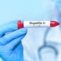 Why Hepatitis A Is a Must-Know for Travellers?