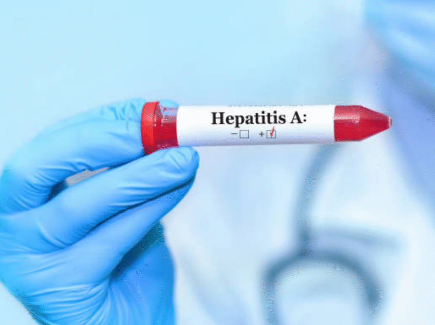 Hepatitis A vaccine